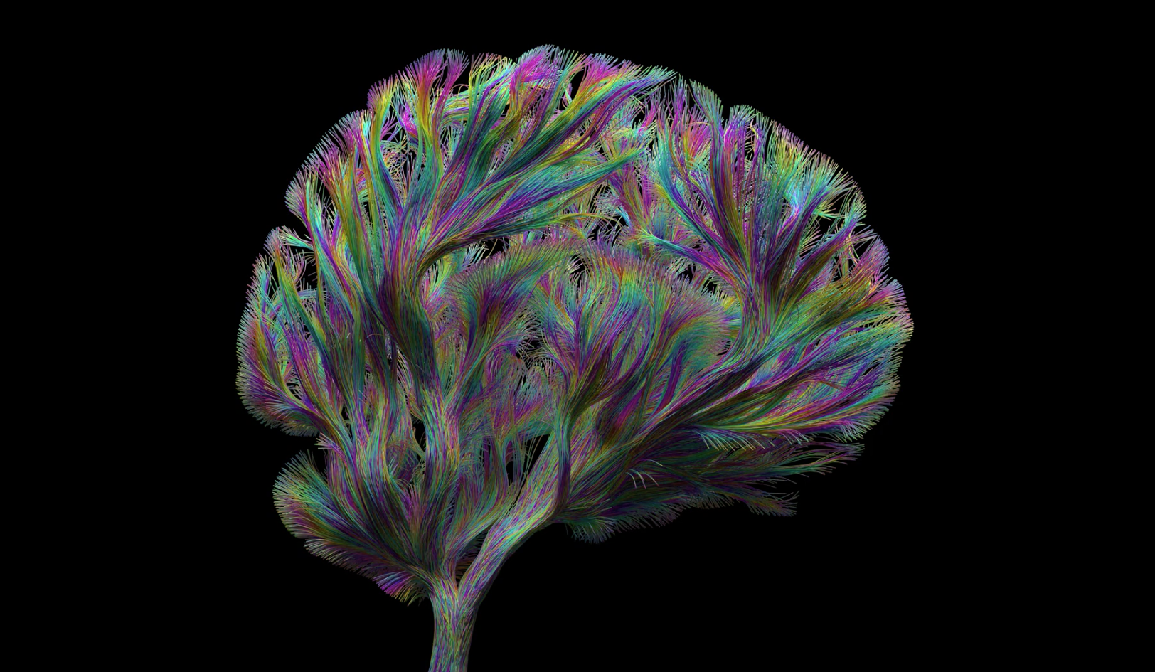 3R Consultants : La puissance de la neuroplasticité dans le leadership ...